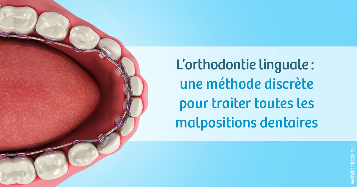 https://dr-boileau-cedric.chirurgiens-dentistes.fr/L'orthodontie linguale 1