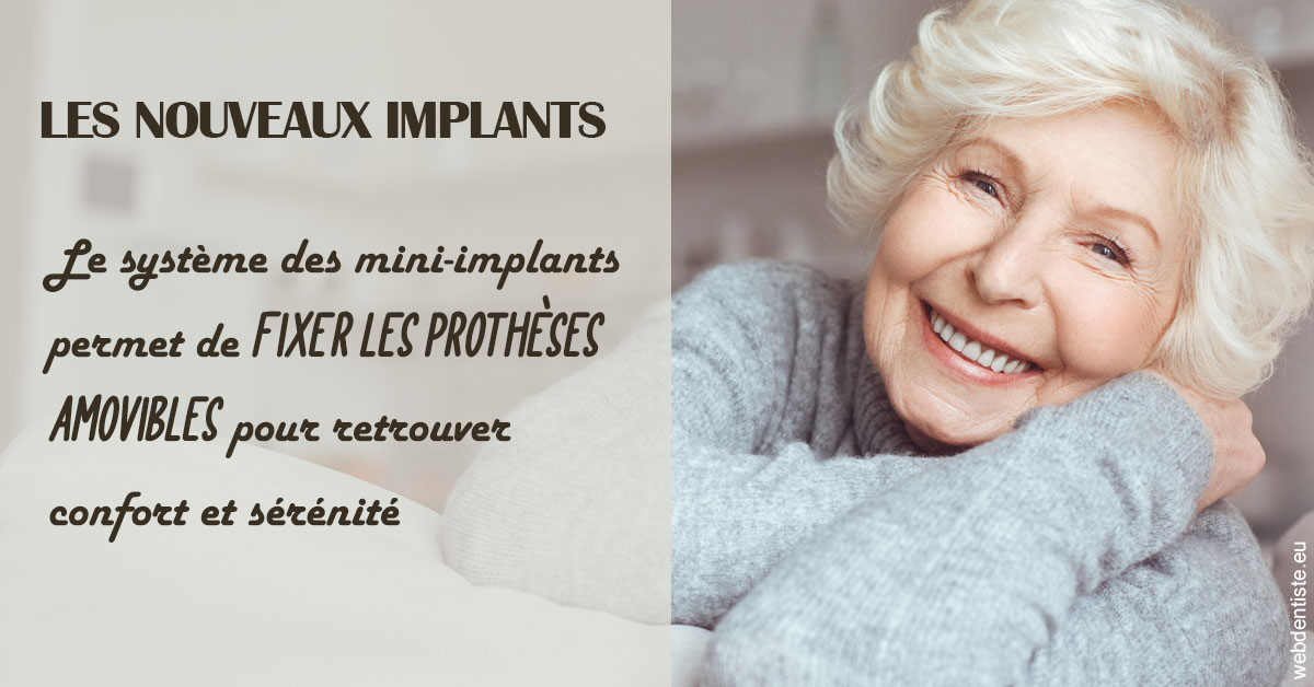 https://dr-boileau-cedric.chirurgiens-dentistes.fr/Les nouveaux implants 1
