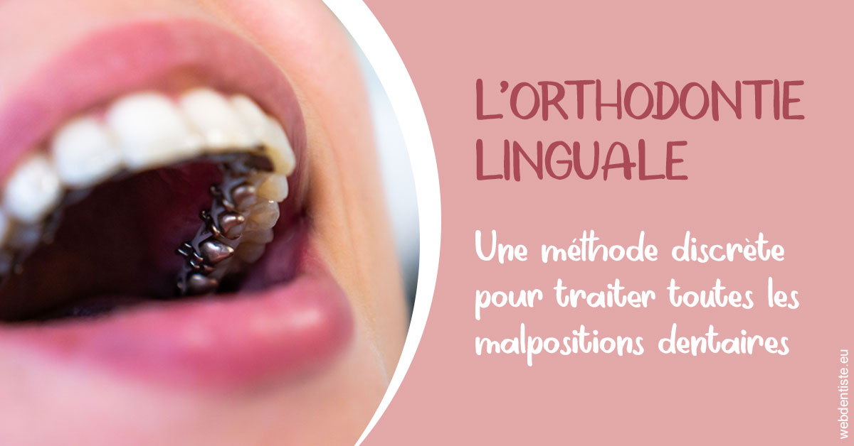 https://dr-boileau-cedric.chirurgiens-dentistes.fr/L'orthodontie linguale 2