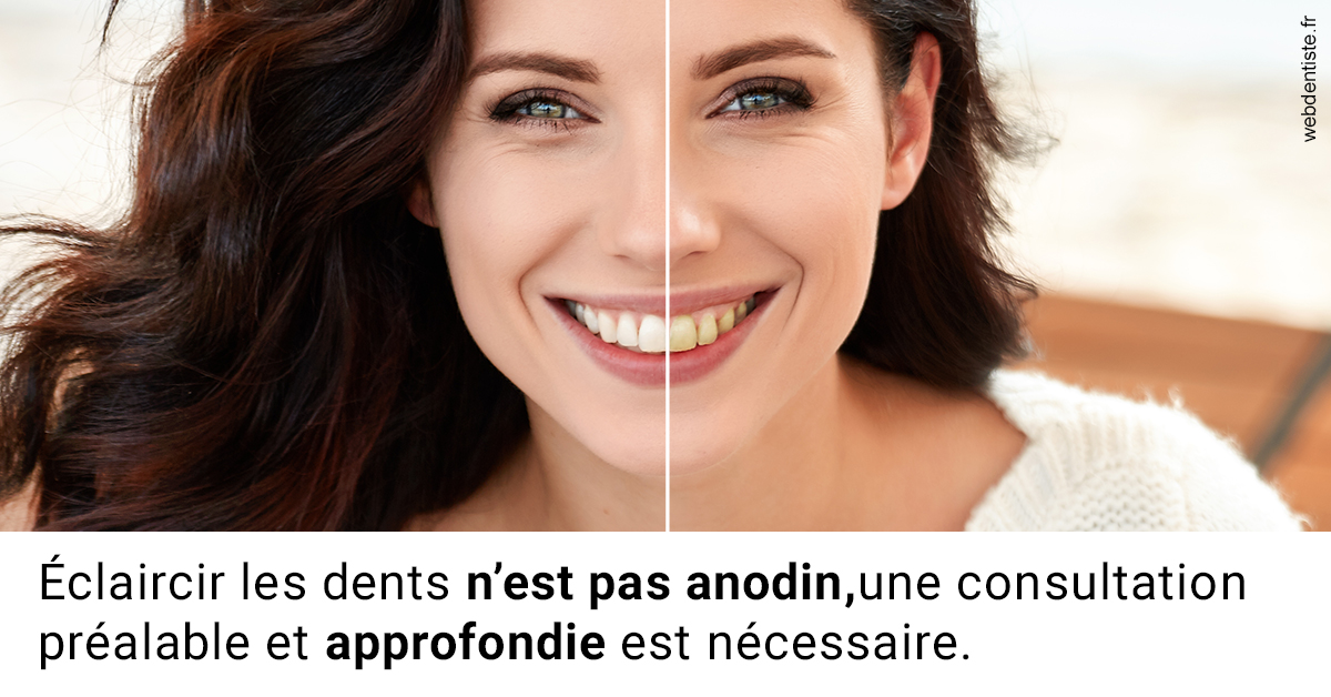 https://dr-boileau-cedric.chirurgiens-dentistes.fr/Le blanchiment 2
