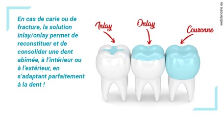 https://dr-boileau-cedric.chirurgiens-dentistes.fr/L'INLAY ou l'ONLAY