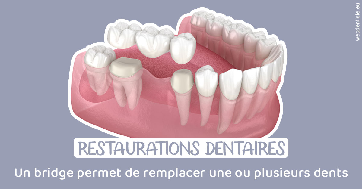 https://dr-boileau-cedric.chirurgiens-dentistes.fr/Bridge remplacer dents 1