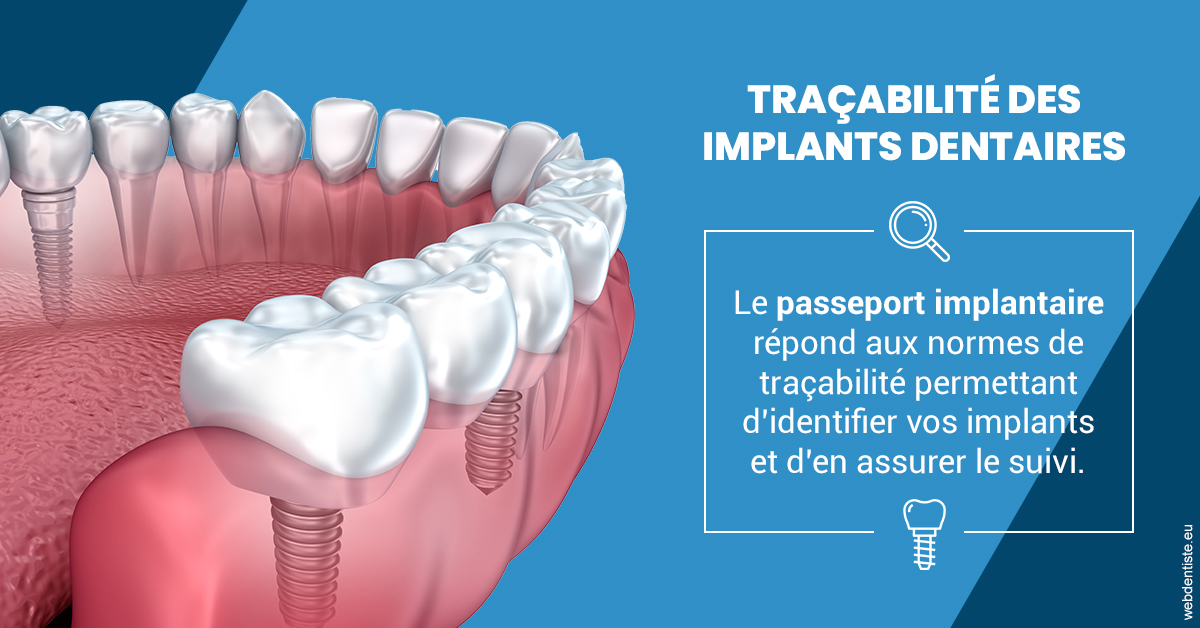 https://dr-boileau-cedric.chirurgiens-dentistes.fr/T2 2023 - Traçabilité des implants 1