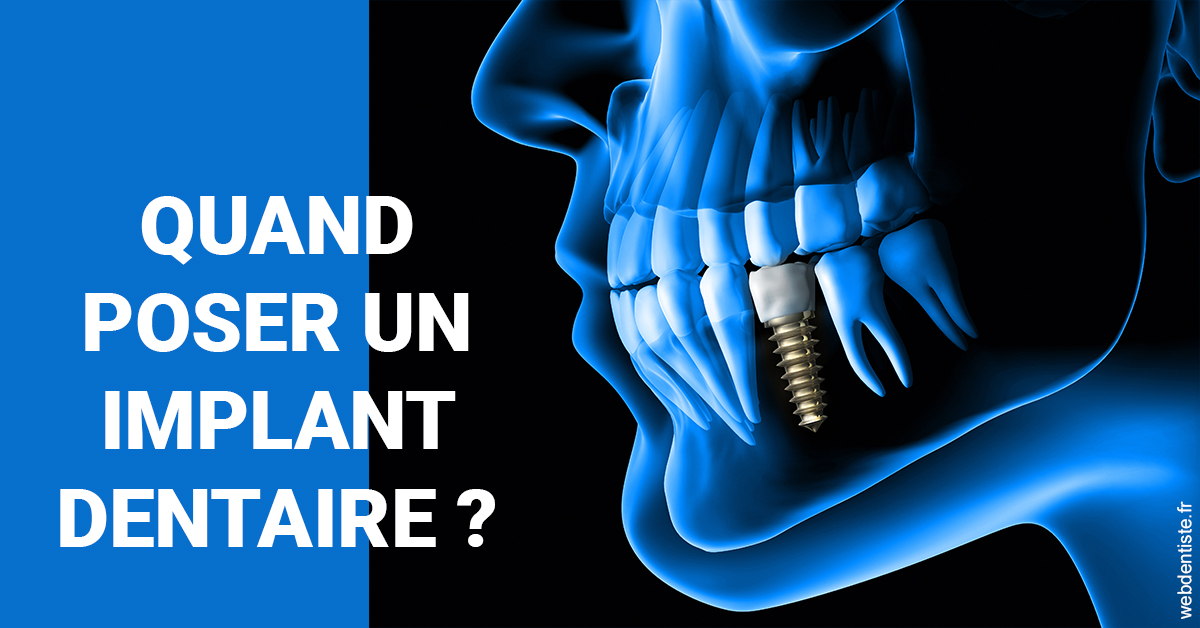 https://dr-boileau-cedric.chirurgiens-dentistes.fr/Les implants 1