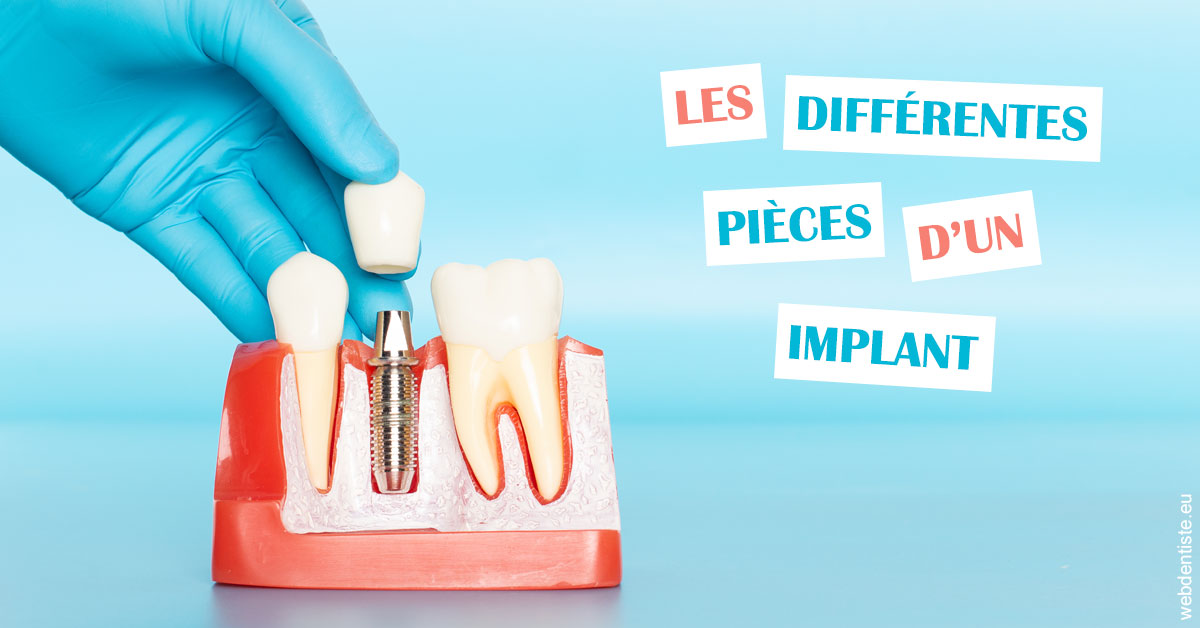 https://dr-boileau-cedric.chirurgiens-dentistes.fr/Les différentes pièces d’un implant 2