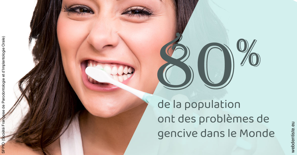 https://dr-boileau-cedric.chirurgiens-dentistes.fr/Problèmes de gencive 1