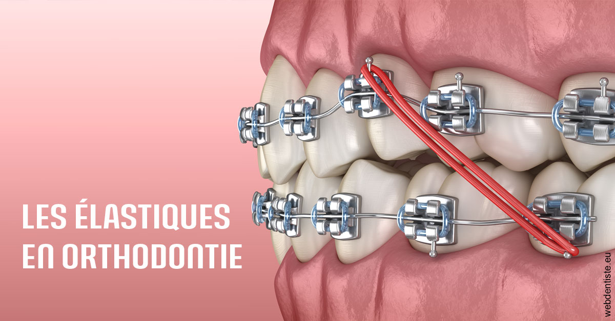 https://dr-boileau-cedric.chirurgiens-dentistes.fr/Elastiques orthodontie 2