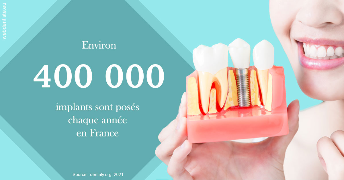 https://dr-boileau-cedric.chirurgiens-dentistes.fr/Pose d'implants en France 2